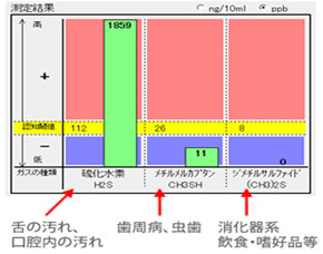 口臭測定器「オーラルクロマ」で分かること