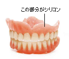 シリコーン義歯（ソフトデンチャー）