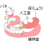 クラスプ義歯